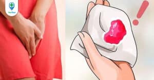 Lưu ý của bác sĩ về những dấu hiệu ung thư âm đạo