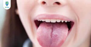 Ung thư miệng sống được bao lâu? Câu trả lời từ bác sĩ