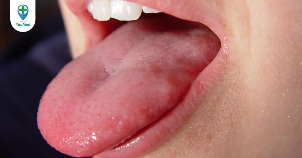 Bệnh nhân mắc ung thư miệng có chữa được không?