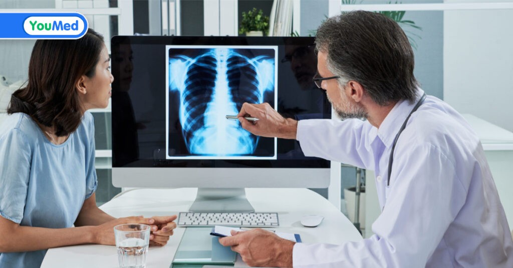 Ung thư phổi sống được bao lâu? Câu trả lời của bác sĩ