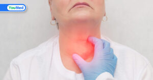 Ung thư tuyến giáp có chữa được không? Câu trả lời của bác sĩ