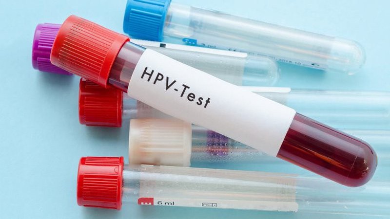 Xét nghiệm HPV giúp phát hiện sự hiện diện của virus Papillomavirrus gây u nhú ở người