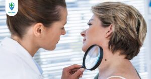 Bệnh viêm da Demodex ở người và những điều cần biết