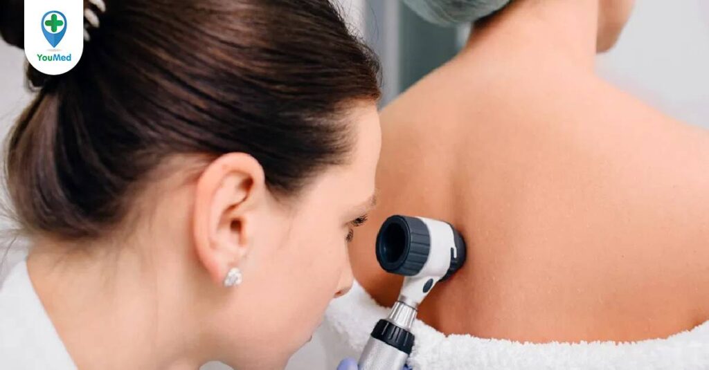 Viêm da dạng Herpes: triệu chứng, nguyên nhân và cách điều trị