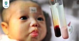 Trẻ thiếu máu uống thuốc gì?