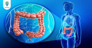 Nguyên nhân ung thư trực tràng và giải đáp đến từ bác sĩ