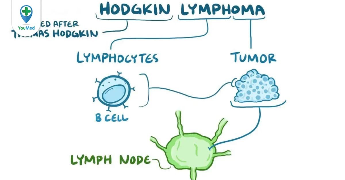 Cùng bác sĩ tìm hiểu về bệnh u lympho hodgkin