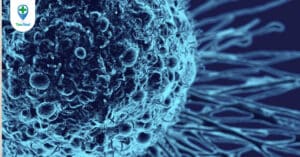 Sự nguy hiểm của ung thư biểu mô đối với sức khỏe