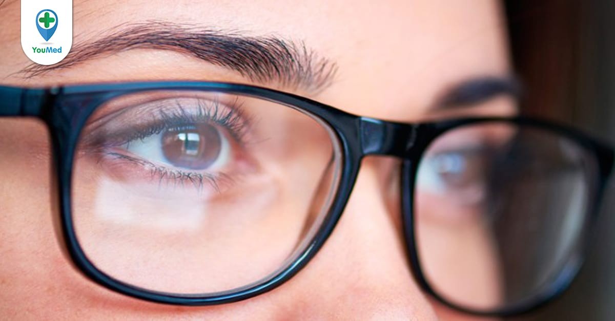 Cận thị: Tật khúc xạ gây suy giảm thị lực hàng đầu ở người trẻ