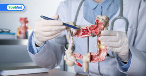 Nguyên nhân ung thư đại tràng và những cảnh báo từ bác sĩ