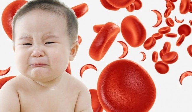 Khi trẻ thiếu máu, các tế bào của trẻ không nhận đủ oxy