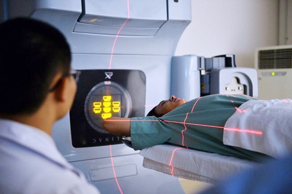 Ung thư phổi: Nguyên nhân, dấu hiệu nhận biết và phương pháp sàng lọc sớm 4 Xạ trị là một trong những cách điều trị ung thư phổi