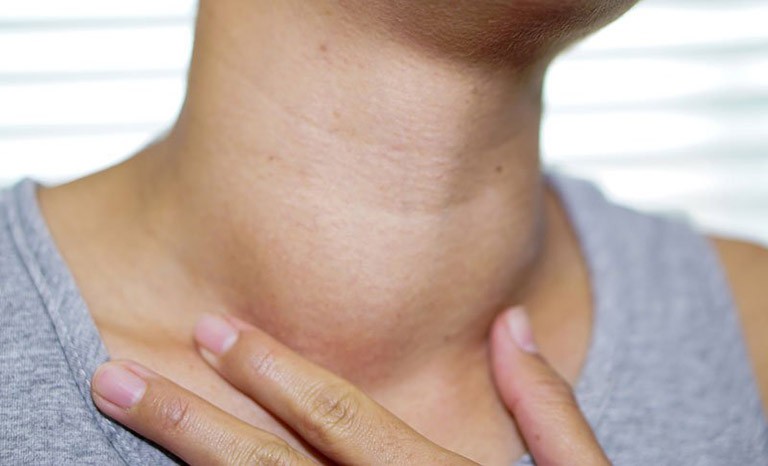 Ung thư tuyến giáp di căn có thể gây sưng cổ và đau rát nhiều