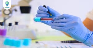 Có những xét nghiệm sùi mào gà nào? Xét nghiệm bao lâu có kết quả?