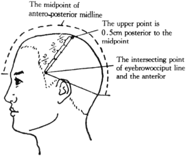 Vị trí khu ngôn ngữ 1