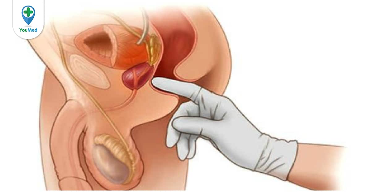 Có những biểu hiện nào cho thấy tuyến tiền liệt bị kích thích không bình thường?
