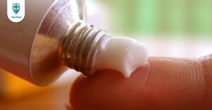 Có nên điều trị viêm da cơ địa tại nhà?