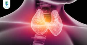 Suy giáp dưới lâm sàng và những điều cần biết