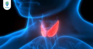 Bướu giáp đơn thuần và những thông tin cơ bản bạn cần biết