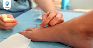 Châm cứu bàn chân và những điều bạn cần lưu ý