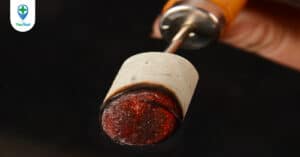 Phương pháp cứu ngải và những điều bạn chưa biết