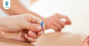 Có nên chữa thoát vị đĩa đệm bằng châm cứu?