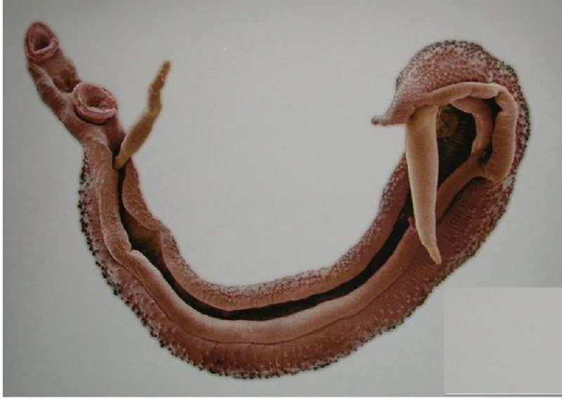 Sán máng (Schistosoma haematobium)