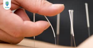 Các phương pháp bổ tả thường dùng trong y học cổ truyền