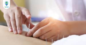 Châm cứu trị gai cột sống và những thông tin cần thiết