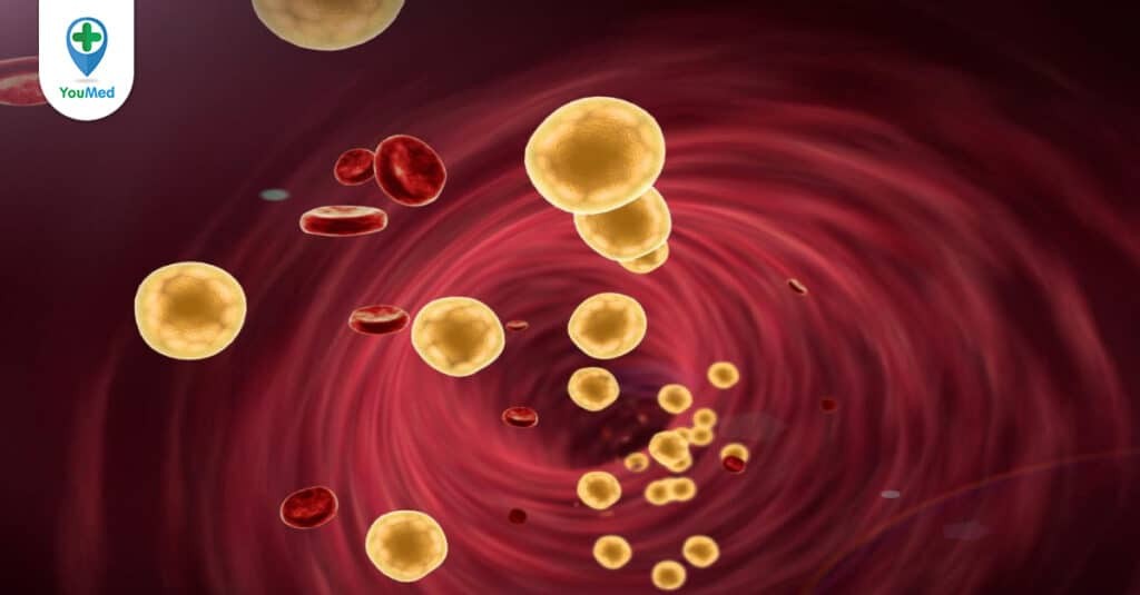 Rối loạn chuyển hóa lipid máu: lý thuyết và thực tiễn