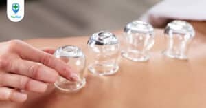 Cách giác hơi như thế nào là đúng và hiệu quả?