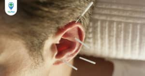 Chữa điếc đột ngột bằng châm cứu có hiệu quả?