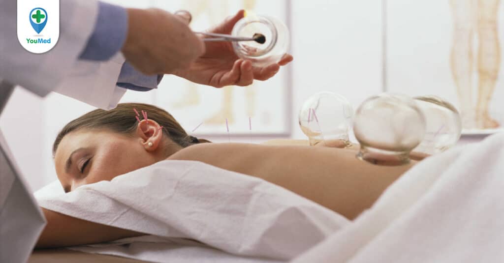 Những điều bạn cần biết về phương pháp giác hơi