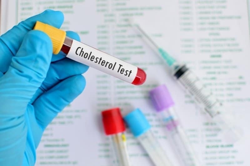 Xét nghiệm cholesterol máu là một phần của xét nghiệm lipid máu