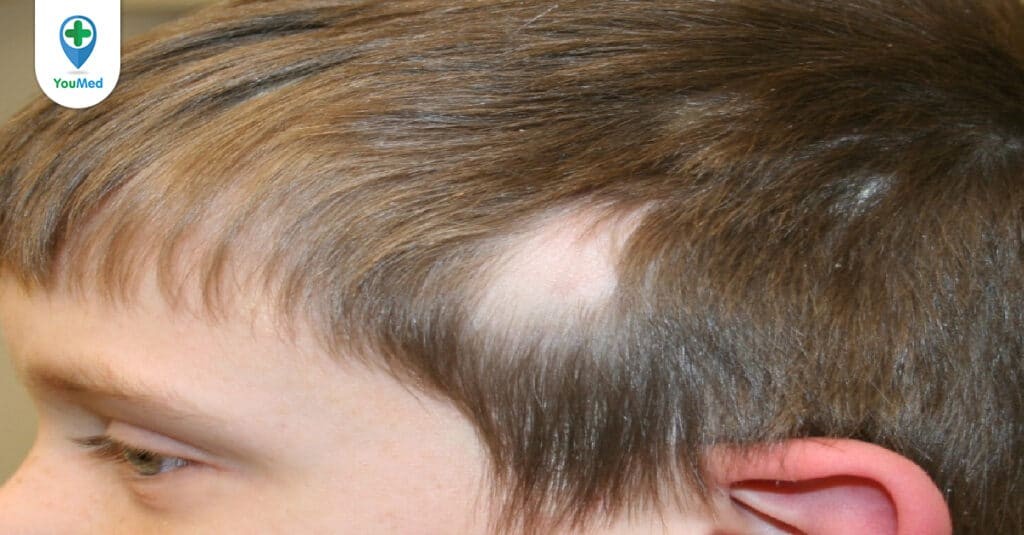 Trẻ bị rụng tóc: Những điều cần biết