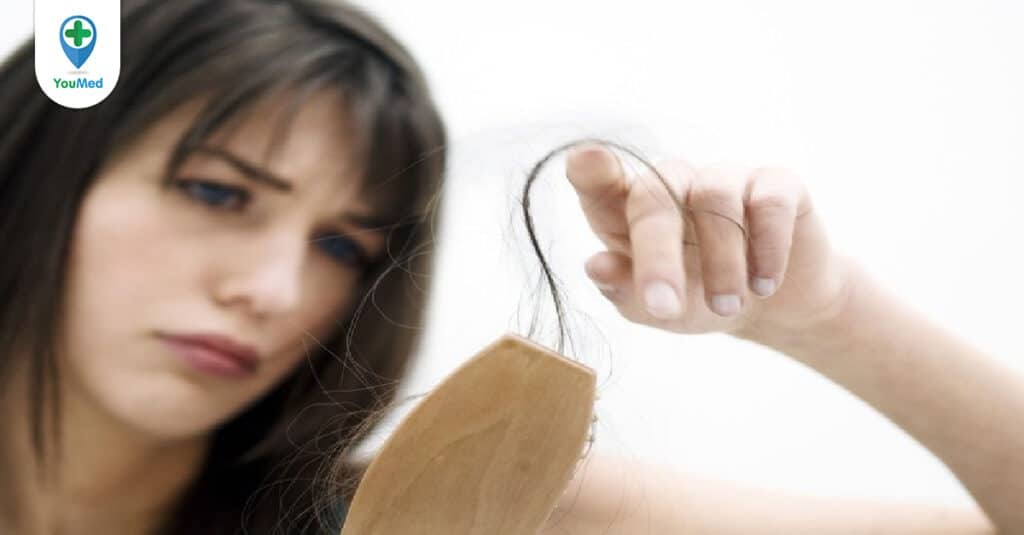 Những điều cần biết để trị rụng tóc hiệu quả