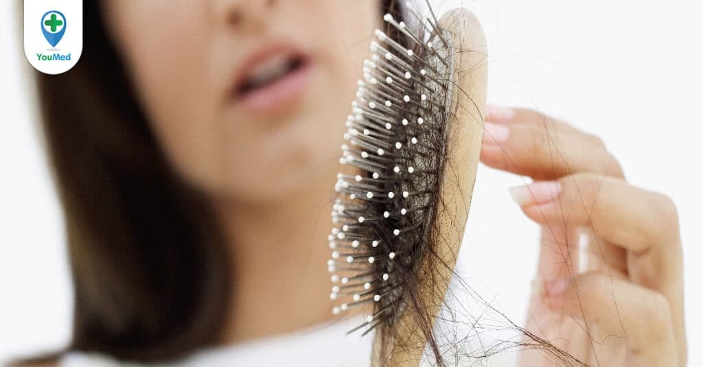 Rụng tóc là bệnh gì và dấu hiệu cần lưu ý?