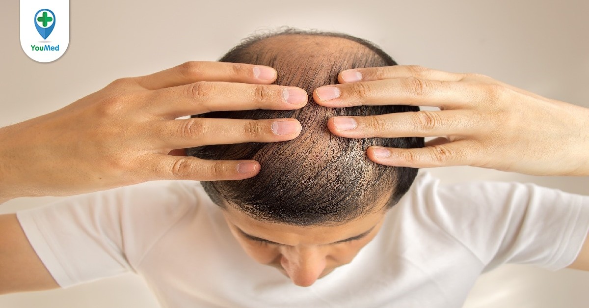 Cách chăm sóc tóc rụng nhiều mà bạn cần nắm