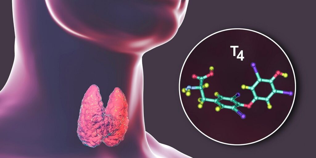Điều trị bằng Thyroxine (T4) nhằm mục đích ức chế sự phát triển của nhân