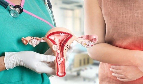 Ung thư cổ tử cung là một trong những biến chứng nguy hiểm nếu nhiễm HPV