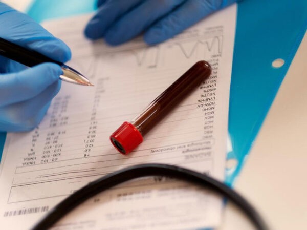 Các chỉ số sinh hóa máu có thể giúp bác sĩ chẩn đoán bệnh viêm túi mật do sỏi