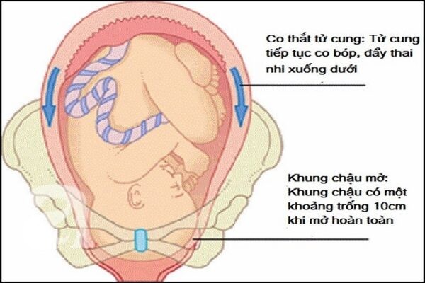 Quá trình co thắt tử cung đẩy thai nhi xuống dưới khung chậu diễn ra trước ngày sinh 1, 2 ngày