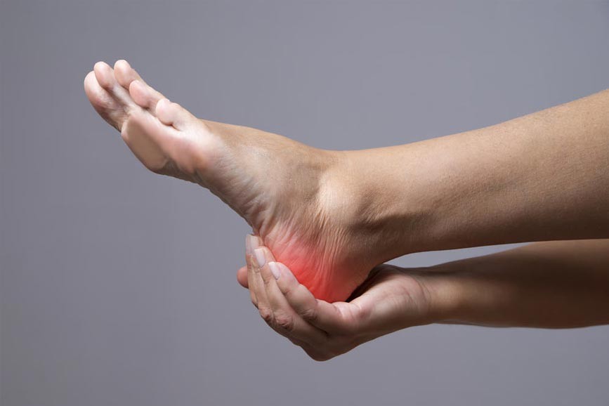 Đau gót chân đa phần liên quan đến viêm gân Achilles
