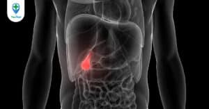 Sỏi bùn túi mật: Nguyên nhân, dấu hiệu, cách điều trị và phòng ngừa