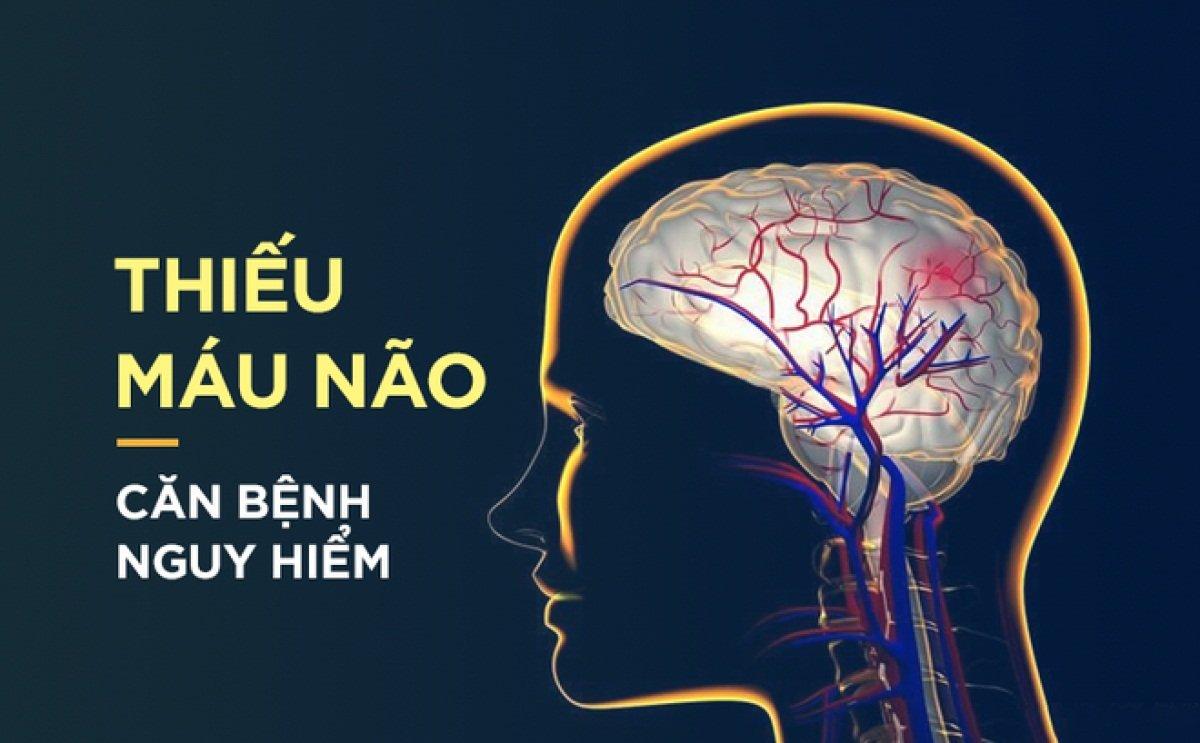 Thiếu máu não là nguyên nhân phổ biến gây mất ngủ kéo dài ở người lớn tuổi và phụ nữ mãn kinh