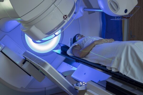 Phương pháp xạ trị dùng các tia tiêu diệt các tế bào ung thư thực quản