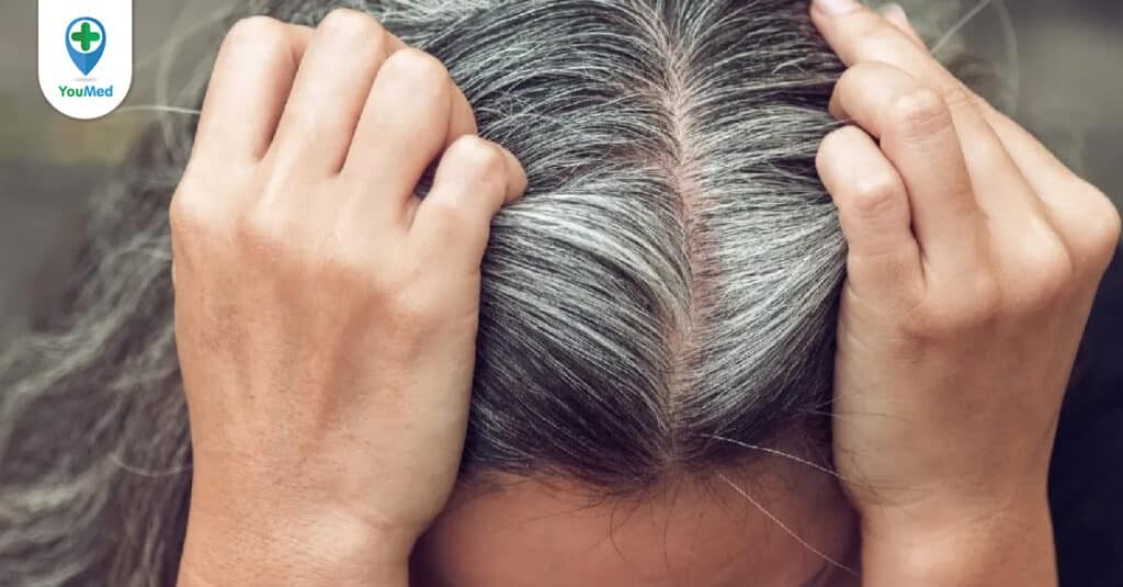 Bật mí cách bấm huyệt trị tóc bạc sớm cho bạn
