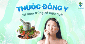 Những loại thuốc Đông y trị mụn trứng cá hiệu quả