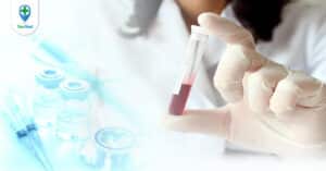 Xét nghiệm GGT là gì? Đối tượng cần xét nghiệm và lưu ý