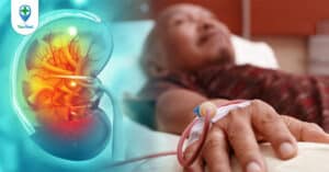 Suy thận mạn tính giai đoạn cuối – Còn bao nhiêu thời gian?